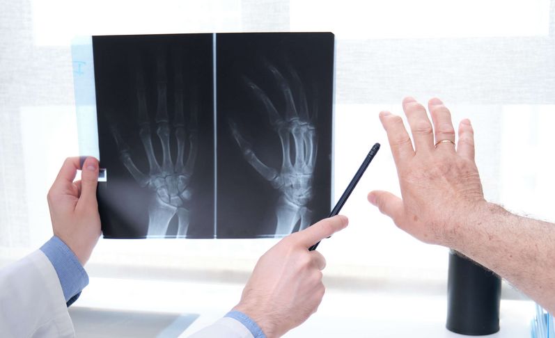 Arzt erklärt Patienten Röntgenbild einer Hand auf dem Computermonitor