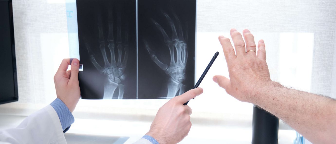 Arzt erklärt Patienten Röntgenbild einer Hand auf dem Computermonitor