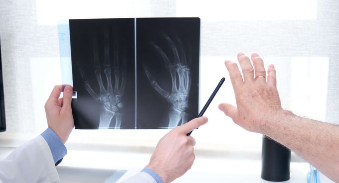 Arzt erklärt Patienten Röntgenbild einer Hand auf dem Computermonitor